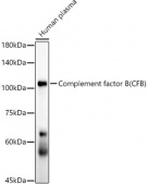 Complement factor B (CFB) Rabbit mAb (A21793)
