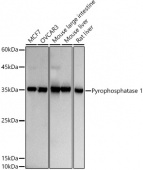 Pyrophosphatase 1 Rabbit mAb (A20942)
