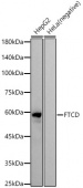 FTCD Rabbit mAb (A22654)