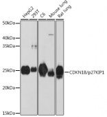 CDKN1B/p27KIP1 Rabbit mAb (A19095)