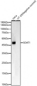 SOAT1 Rabbit mAb (A23284)