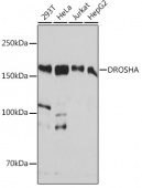 DROSHA Rabbit mAb (A19598)