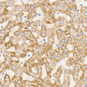MT-ND6 Rabbit mAb (A21250)