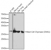 Mast Cell Chymase (CMA1) Rabbit mAb (A11480)