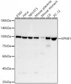 KPNB1 Rabbit mAb (A23235)