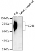 CD86 Rabbit mAb (A21198)