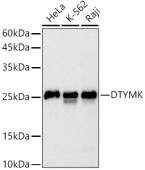 DTYMK Rabbit mAb (A20921)