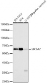 SLC6A2 Rabbit mAb (A22765)