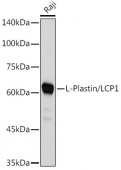 L-Plastin/LCP1 Rabbit mAb (A4664)