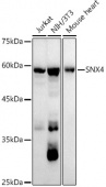 SNX4 Rabbit mAb (A21130)