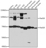 Rad18 Rabbit mAb (A4339)