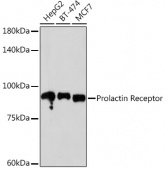 Prolactin Receptor Rabbit mAb (A4121)