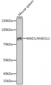 MAD1/MAD1L1 Rabbit mAb (A5098)
