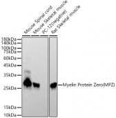 Myelin Protein Zero (MPZ) Rabbit mAb (A21931)