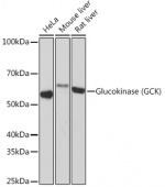 Glucokinase (GCK) Rabbit mAb (A5170)