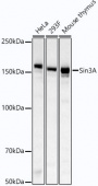 Sin3A Rabbit mAb (A21966)