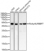 RbAp46/RBBP7 Rabbit mAb (A22274)
