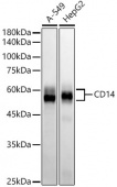 CD14 Rabbit mAb (A21256)
