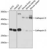 Cathepsin D Rabbit mAb (A19680)