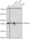 PSMD14 Rabbit mAb (A9608)