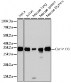 Cyclin D3 Rabbit mAb (A3989)