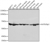 KAT9/Elp3 Rabbit mAb (A0020)