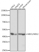 MEK1/MEK2 Rabbit mAb (A4868)