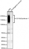 CD138/Syndecan-1 Rabbit mAb (A23249)
