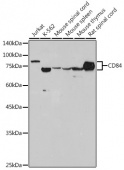 CD84 Rabbit mAb (A2299)