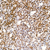 CD35/CR1 Rabbit mAb (A3661)