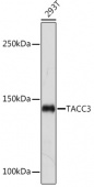 TACC3 Rabbit mAb (A19617)