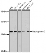 Neurogenin 2 Rabbit mAb (A19800)