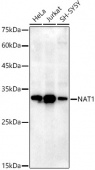 NAT1 Rabbit mAb (A20897)
