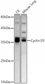 Cyclin D1 Rabbit mAb (A22104)