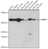 RBBP4 Rabbit mAb (A3645)