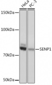 SENP1 Rabbit mAb (A4460)