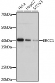 ERCC1 Rabbit mAb (A4971)