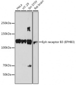 Eph receptor B3 (EPHB3) Rabbit mAb (A19229)