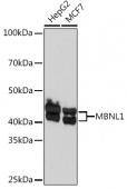 MBNL1 Rabbit mAb (A5149)