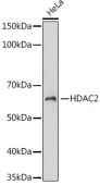 HDAC2 Rabbit mAb (A22426)