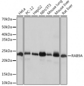 RAB9A Rabbit mAb (A4894)