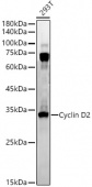 Cyclin D2 Rabbit mAb (A22261)