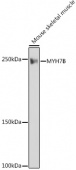 MYH7B Rabbit mAb (A19246)