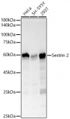 Sestrin 2 Rabbit mAb (A23685)