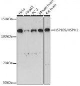 HSP105/HSPH1 Rabbit mAb (A4687)