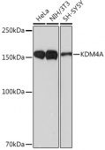 KDM4A Rabbit mAb (A9267)