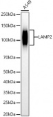 LAMP2 Rabbit mAb (A22482)