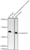 Cystatin B Rabbit mAb (A20886)