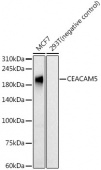 CEACAM5 Rabbit mAb (A22266)
