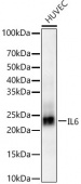 IL6 Rabbit mAb (A22222)